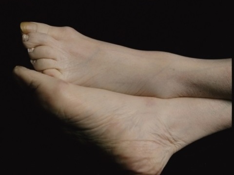 Andres Serrano, aus der Serie: The Morgue, 1992, Fotografie, 139,7 x 165,1 cm Andres Serrano, aus der Serie: The Morgue, 1992, Fotografie, 139,7 x 165,1 cm